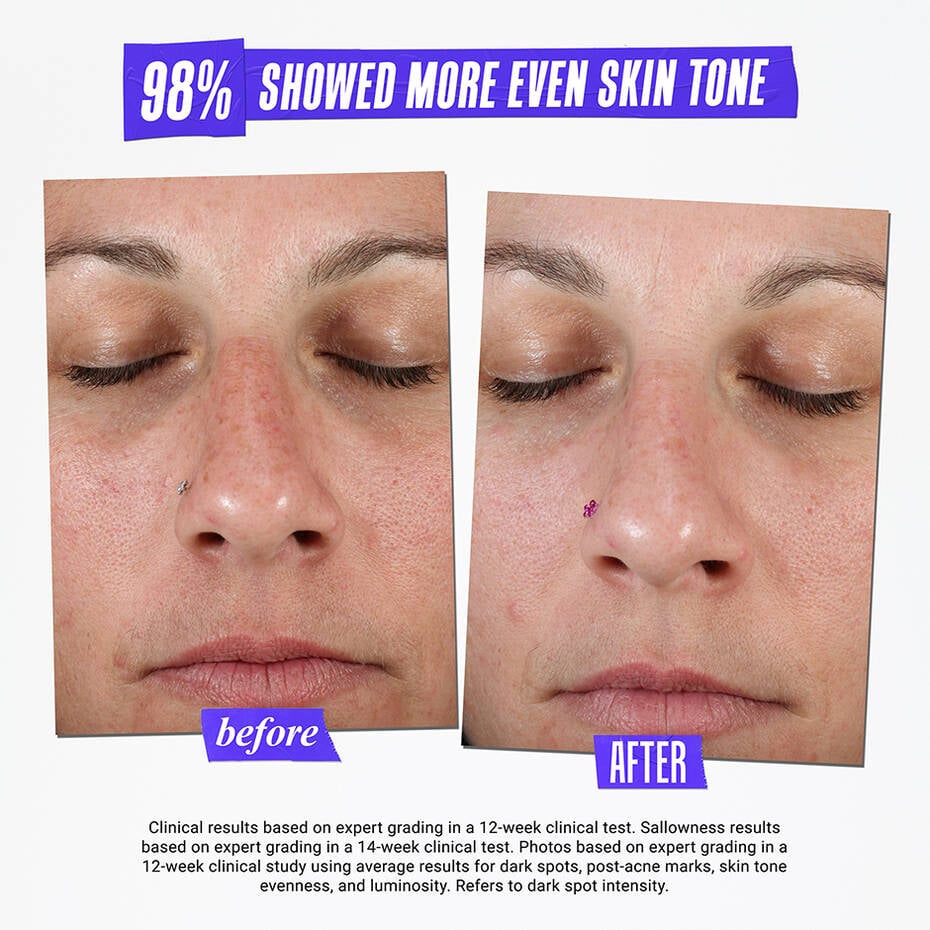 Kiehl's Clearly Corrective Dark Spot Solution