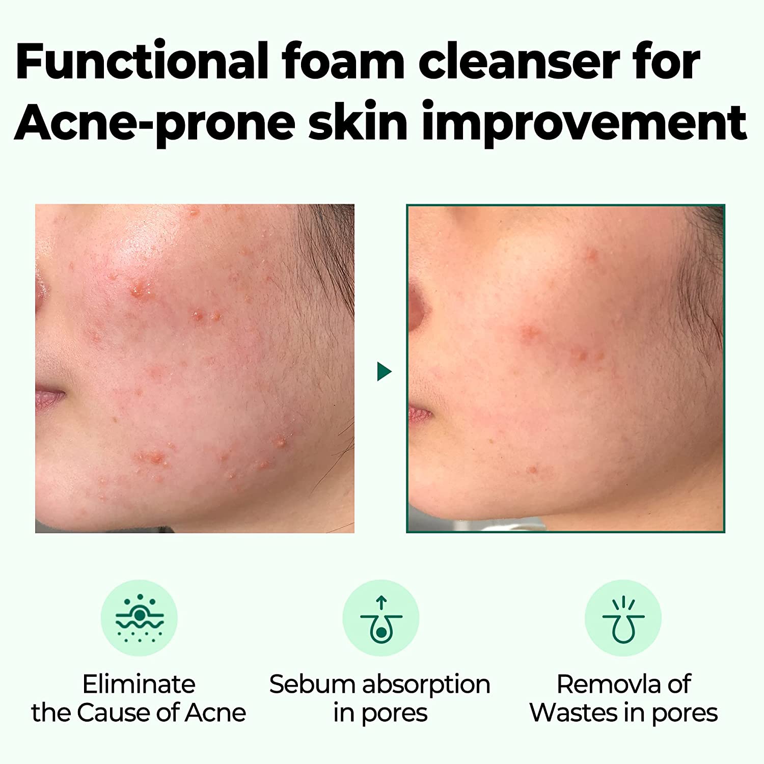 Some By Mi AHA BHA PHA 30 Days Miracle Acne Clear Foam