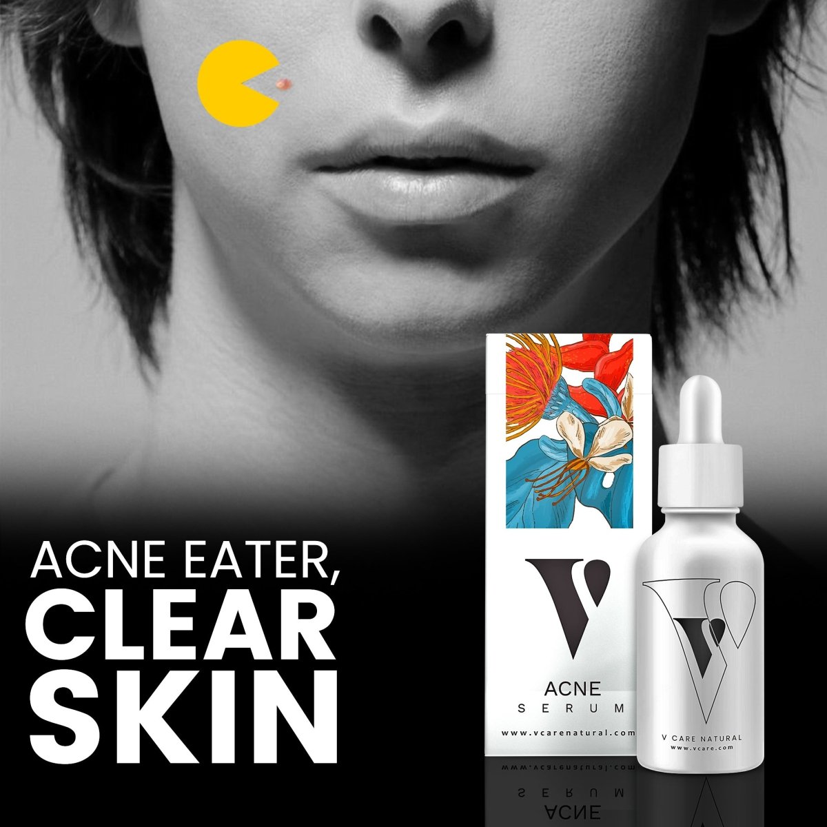 VCARE Natural Acne Serum - VCARE NATURAL